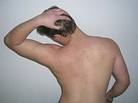 Testimonial Eric Chiropraktik